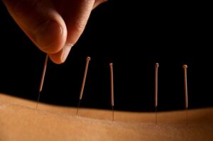 Balance Acupuncture & Wellness Center