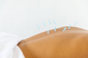 Dr. Marilyn Jackson Acupuncture